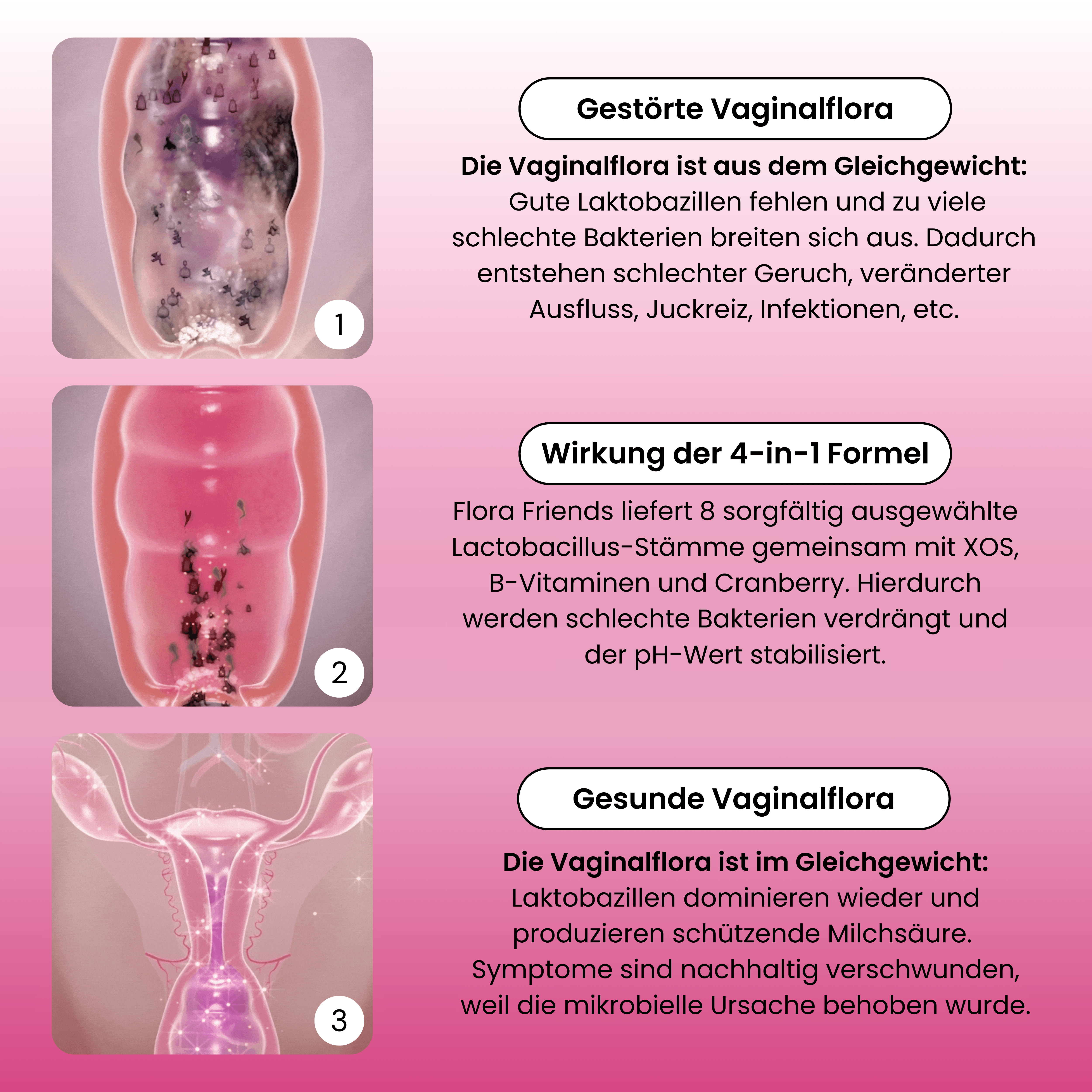 Gestörte Vaginalflora; Wirkung der 4-in-1 Formel; Gesunde Vaginalflora