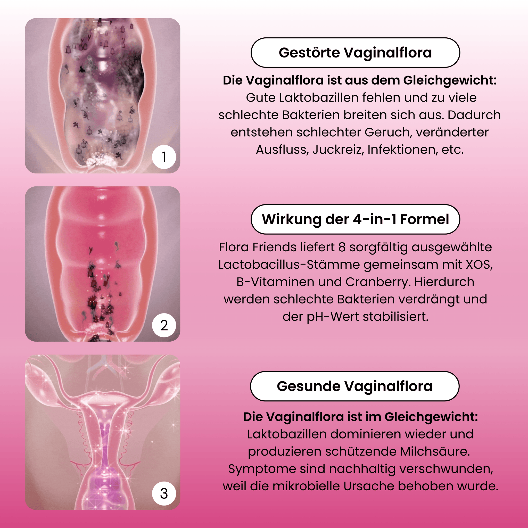 Gestörte Vaginalflora; Wirkung der 4-in-1 Formel; Gesunde Vaginalflora